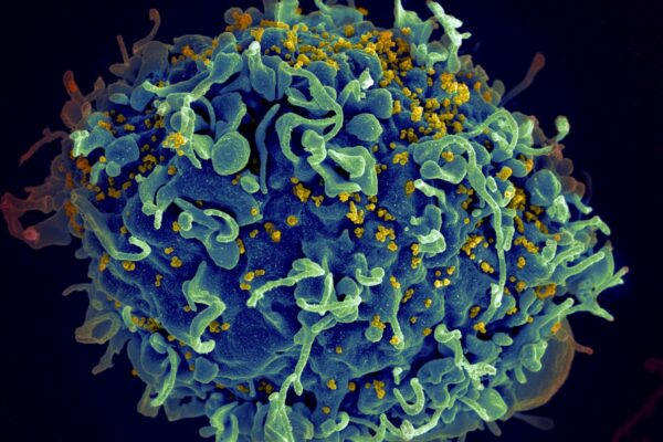 Scientists hail breakthrough putting them on ‘pathway to an HIV cure’ … from the Independent Athena Stavrou