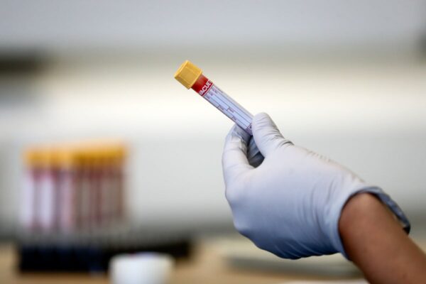 ‘Promising’ new test could detect pancreatic cancer in its early stages … from the Independent Jane Kirby