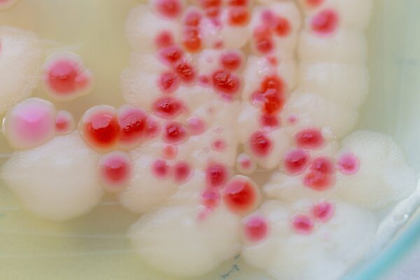 Expert reveals the danger of pink soap scum – and how to get rid of it … from the Independent Dr Michael Taylor