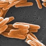 Tuberculosis cases are surging in the UK: Symptoms and advice you need to know … from the Independent Amy-Clare Martin