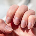 What the look of your nails says about your health … from the Independent Lara Owen