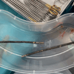Surgeons remove up to 100 magnets from New Zealand teen’s gut … from the Independent Vishwam Sankaran