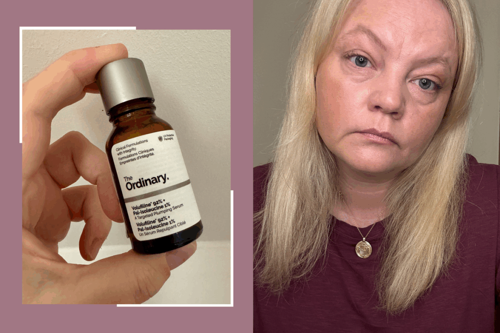 The Ordinary’s new ‘filler in a bottle’ serum made me look ‘more youthful’ in my 40s … from the Independent Sabine Wiesel